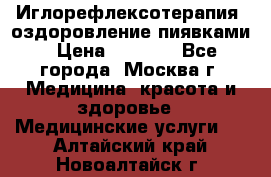 Иглорефлексотерапия, оздоровление пиявками › Цена ­ 3 000 - Все города, Москва г. Медицина, красота и здоровье » Медицинские услуги   . Алтайский край,Новоалтайск г.